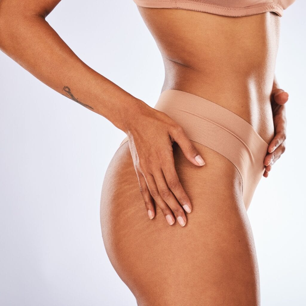Woman, stretch marks and underwear in studio for beauty, dermatology spa and skincare wellness. Female model, cellulite and body waist for cosmetic diet, aesthetic liposuction and mockup background
